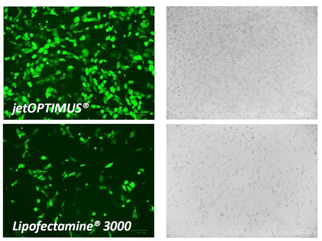 Image of cell transfected with GFP